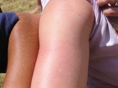 Media_http3bpblogspot_gibda